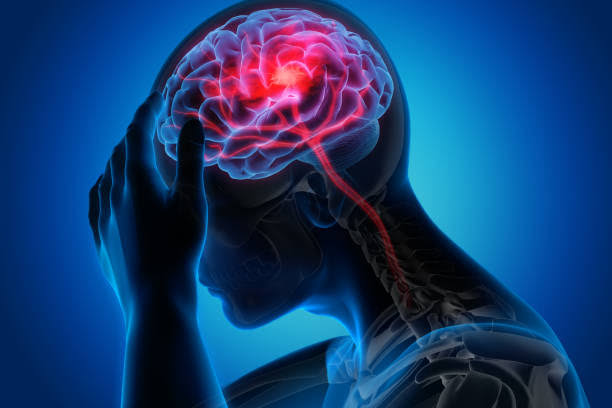 Neurological Problems