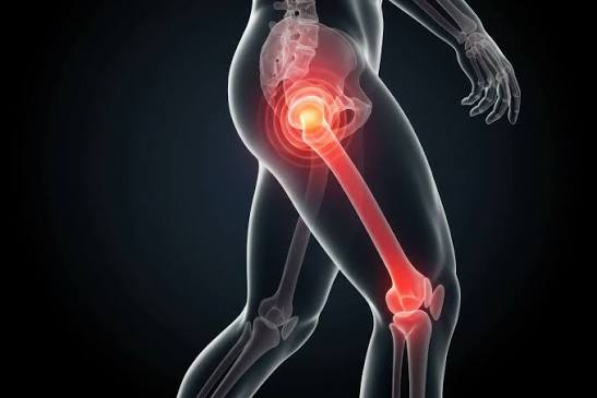 Hip Pain & Knee Pain